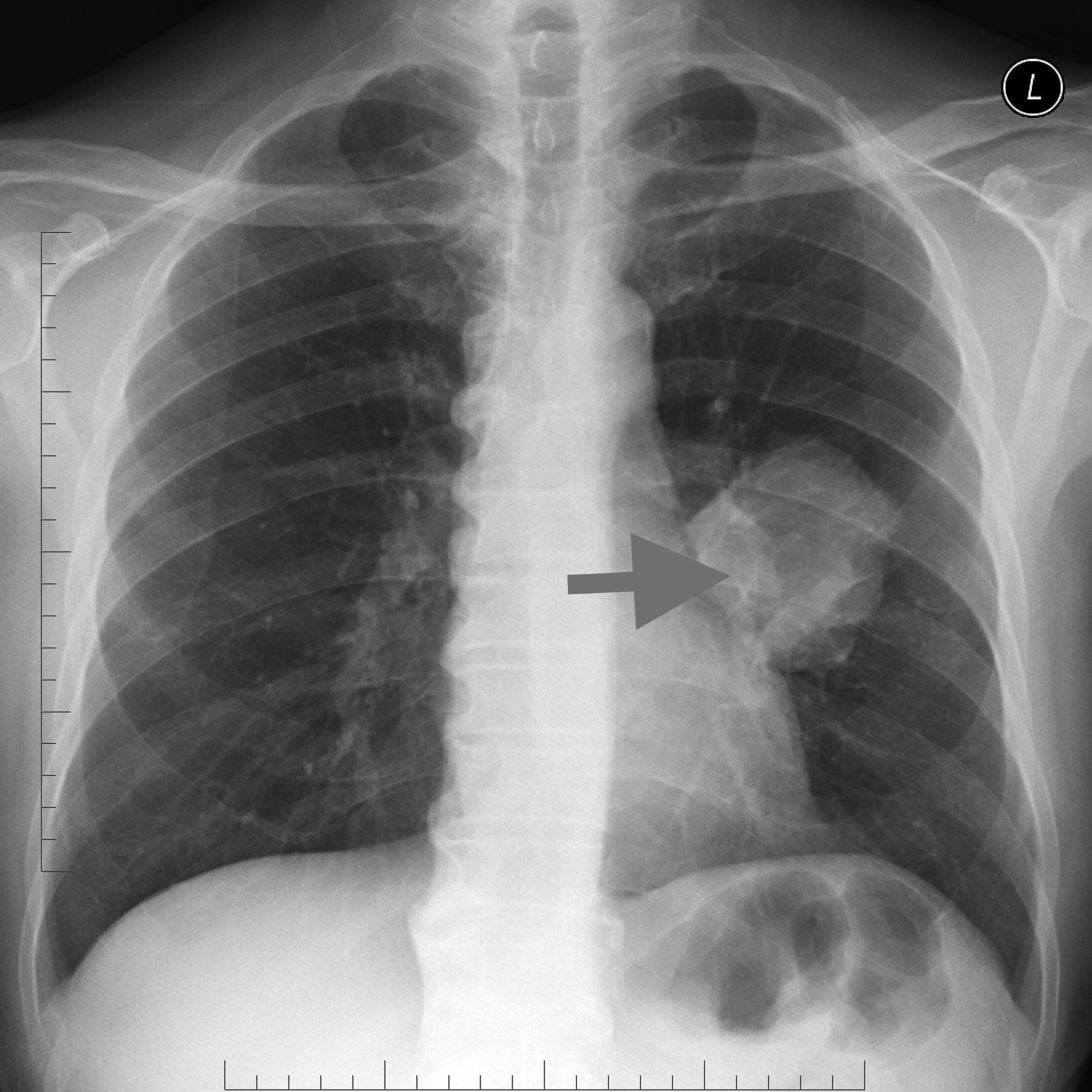 Respiratory Pathology